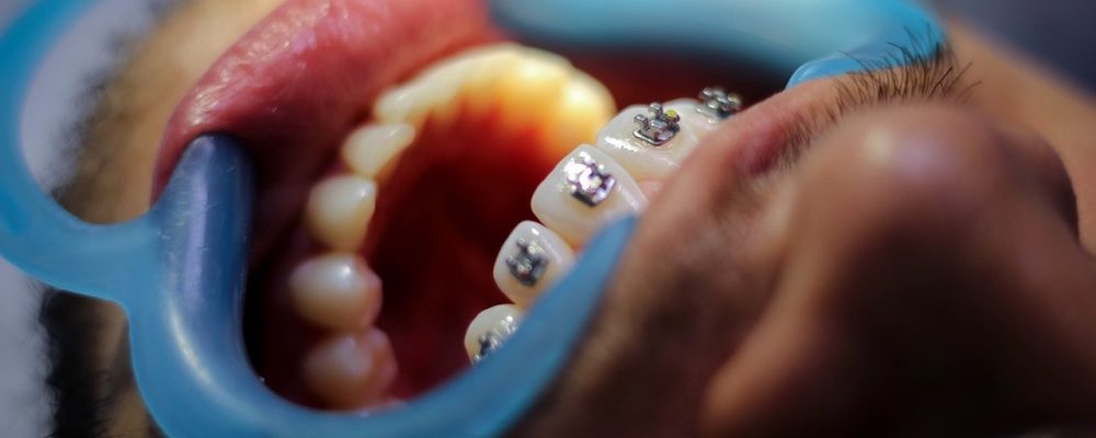 orthodontics orthodontics